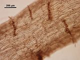 8 - Dettaglio delle cellule corticali in una porzione adulta del tallo